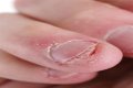 Why Are My Nails So Hard All Of A Sudden
